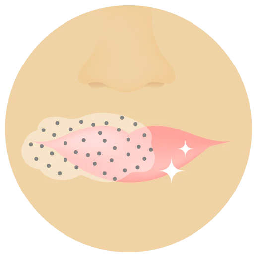 illustration des lèvres d’une personne sur lesquelles Slaai et Bamboo Booster sont appliqués, sur une partie des lèvres