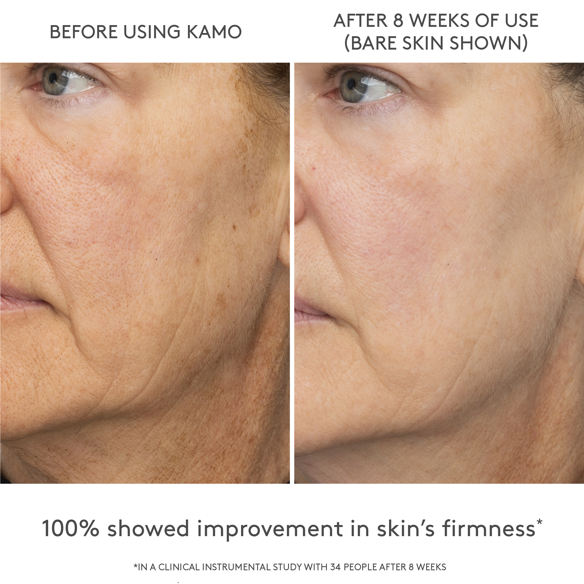 Kamo Triple-Peptide&trade; Gouttes de teint, Tr&egrave;s clair 2C